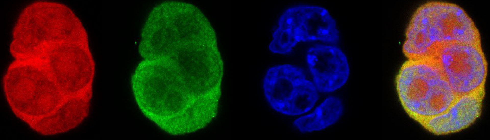 《自然-細(xì)胞生物學(xué)》發(fā)表腦智卓越中心關(guān)于基因表達(dá)動(dòng)態(tài)示蹤的新技術(shù)